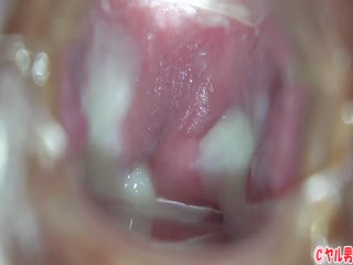 小美女内窥镜自慰啪啪自拍